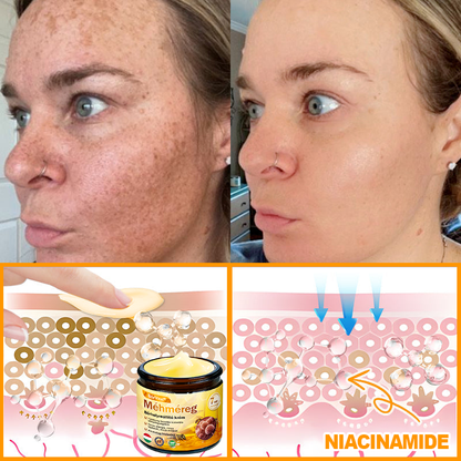 🐝🐝 ZödVita® Méhméreg Bőr Helyreállító Krém (👨‍⚕‍CE jóváhagyott)👍✅