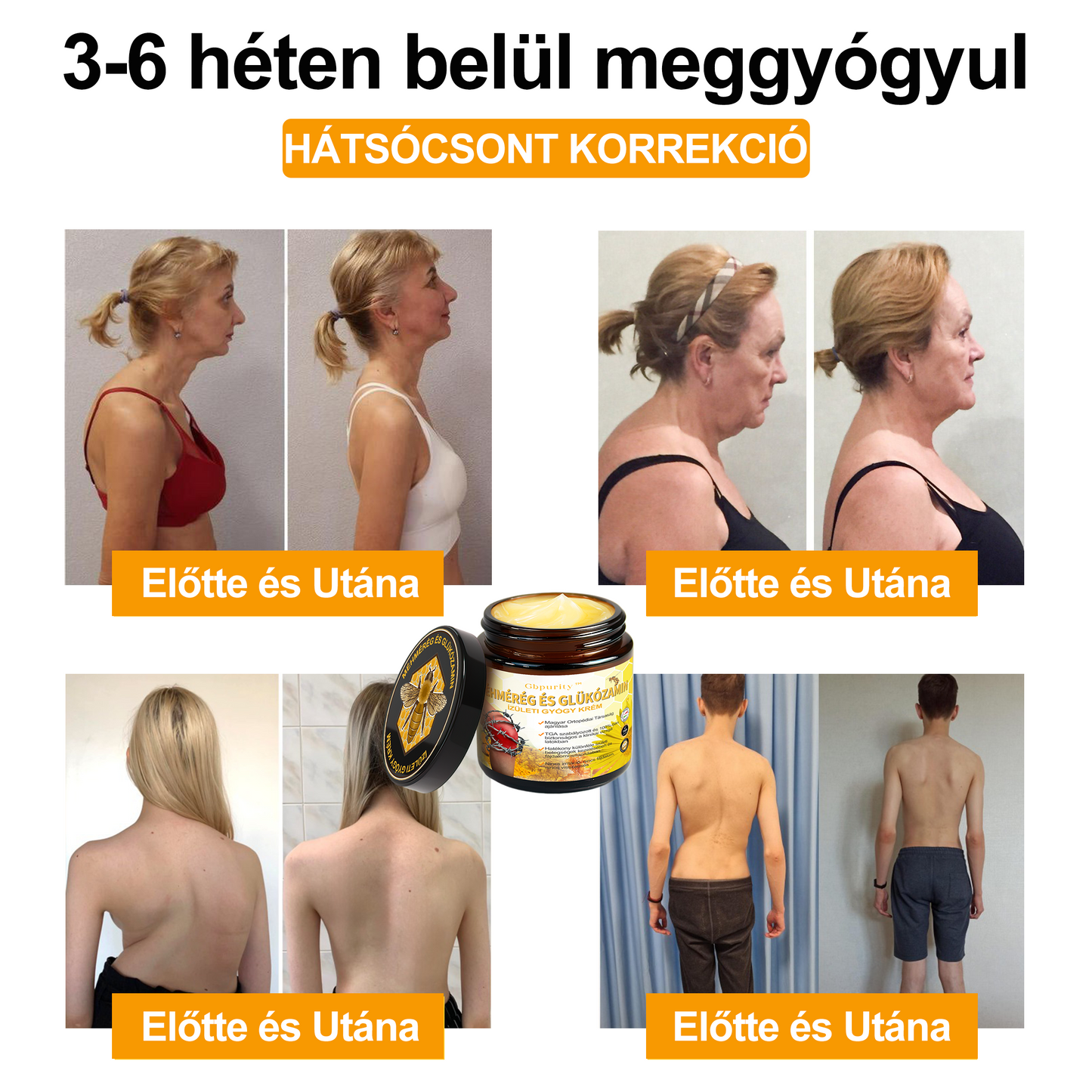 Gbpurity Méhméreg és Glükózamin Ízületi Krém – Hivatalos Márkabolt, MOT Jóváhagyással