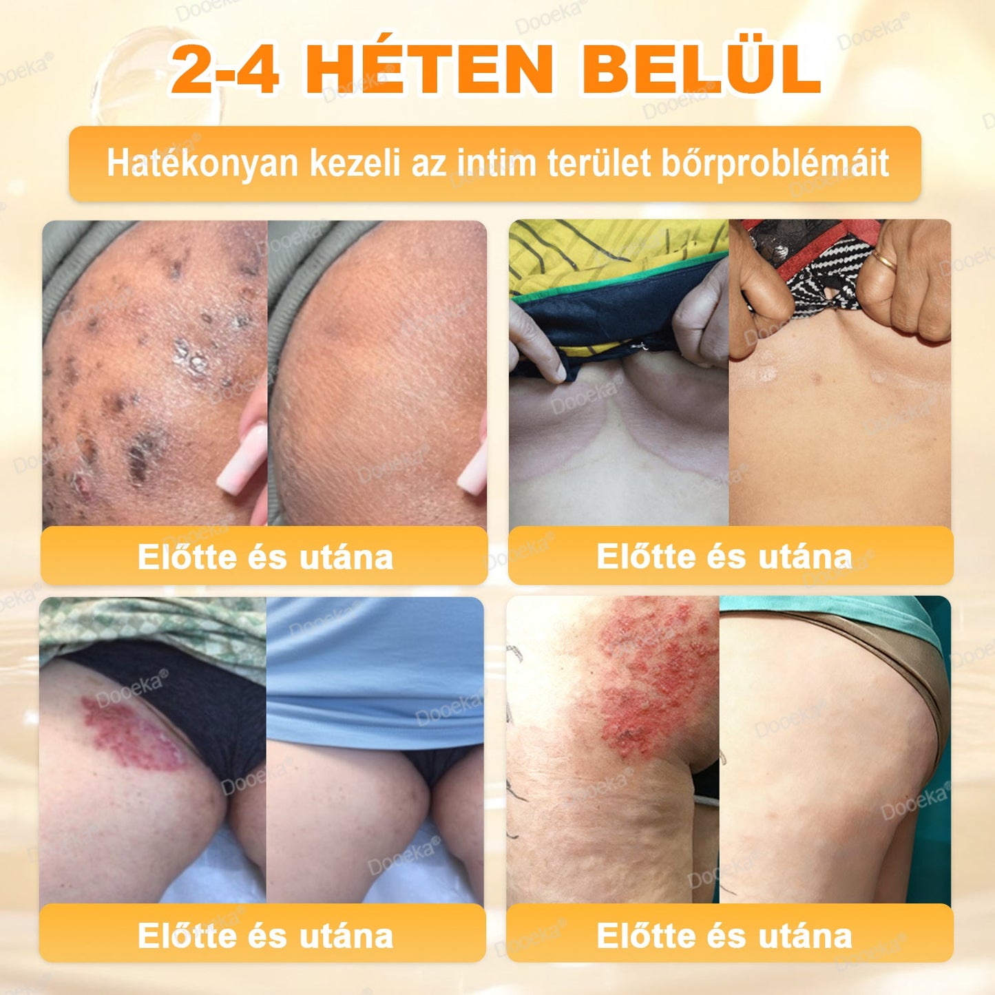 Dooeka® 𝟖-𝐈𝐧-𝟏 Méhméreg & Tallow Bőrfirmító és Regeneráló Krém ⭐ (7 napon belül hatékony) Méhméreg + Tallow · 7X Mélyhidratálás, célozza meg a ráncokat, megereszkedést, striákat, sötét foltokat, purpurát, gyulladásokat és még sok mást.