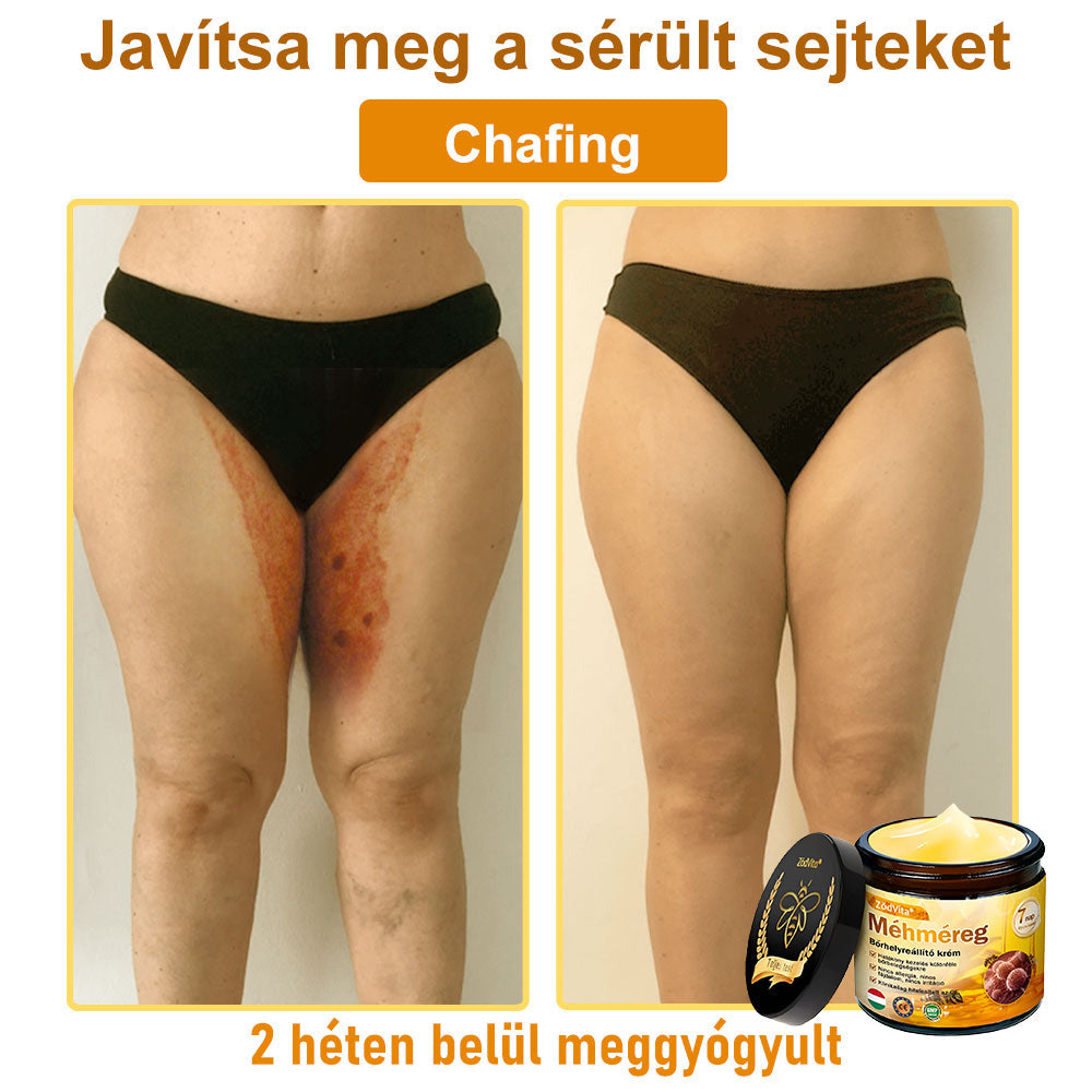 HU🐝✨ ZödVita® Méhméreg Bőr Helyreállító Krém 🔥 Magyar fejlesztés, magyarországi gyártás és szállítás