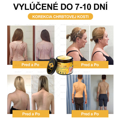 XRLXRL™ Krém na úľavu od bolesti a hojenie kostí s včelím jedom 🦴(Špeciálne pre starších dospelých a odporúčaný AAOS👍)