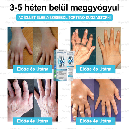 2️⃣ 𝐆𝐛𝐩𝐮𝐫𝐢𝐭𝐲™ 𝐇𝐢𝐚𝐥𝐮𝐫𝐨𝐧𝐬𝐚𝐯𝐚𝐬 Í𝐳ü𝐥𝐞𝐭𝐢 𝐑𝐞𝐠𝐞𝐧𝐞𝐫á𝐥ó 𝐊𝐫é𝐦👩‍⚕️(Á𝐭𝐟𝐨𝐠ó 𝐤𝐞𝐳𝐞𝐥é𝐬 𝐚𝐳 í𝐳ü𝐥𝐞𝐭𝐢 𝐠𝐲𝐮𝐥𝐥𝐚𝐝á𝐬𝐫𝐚, 𝐢𝐝𝐞𝐠𝐟á𝐣𝐝𝐚𝐥𝐨𝐦𝐫𝐚, 𝐢𝐳𝐨𝐦𝐟á𝐣𝐝𝐚𝐥𝐨𝐦0𝐫𝐚）