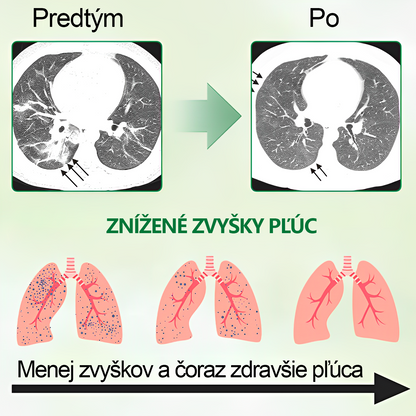 SVK🍀𝐆𝐨𝐨𝐲𝐞𝐞𝐫™ Vysoko kvalitný pľúcny sprej -🧑‍⚕️ Podporuje zdravie pľúc, priedušiek a dutín, podporuje zdravie dýchacieho systému a ľahšie dýchanie.