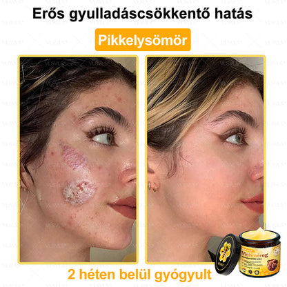 ✨✨✨💪VLSVLS® Méhméreg Bőrhelyreállító Krém (👨‍⚕‍CE jóváhagyott)👍✅