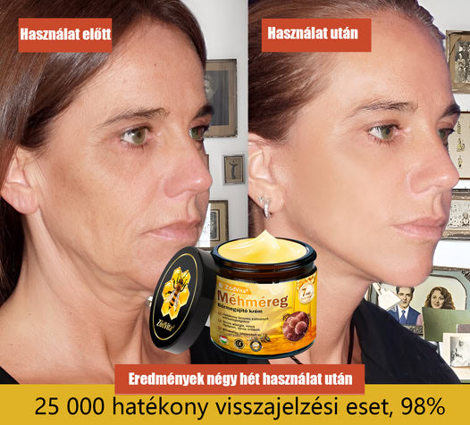 Bőrgyógyász ajánlása ✨ ZödVita® Méhméreg Bőr Helyreállító Krém 🍂 Magyar fejlesztés, magyarországi gyártás és szállítás