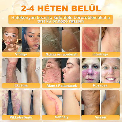 Dooeka® 𝟖-𝐈𝐧-𝟏 Méhméreg & Tallow Bőrfirmító és Regeneráló Krém ⭐ (7 napon belül hatékony) Méhméreg + Tallow · 7X Mélyhidratálás, célozza meg a ráncokat, megereszkedést, striákat, sötét foltokat, purpurát, gyulladásokat és még sok mást.