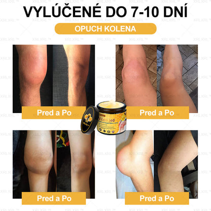 XRLXRL™ Krém na úľavu od bolesti a hojenie kostí s včelím jedom 🦴(Špeciálne pre starších dospelých a odporúčaný AAOS👍)