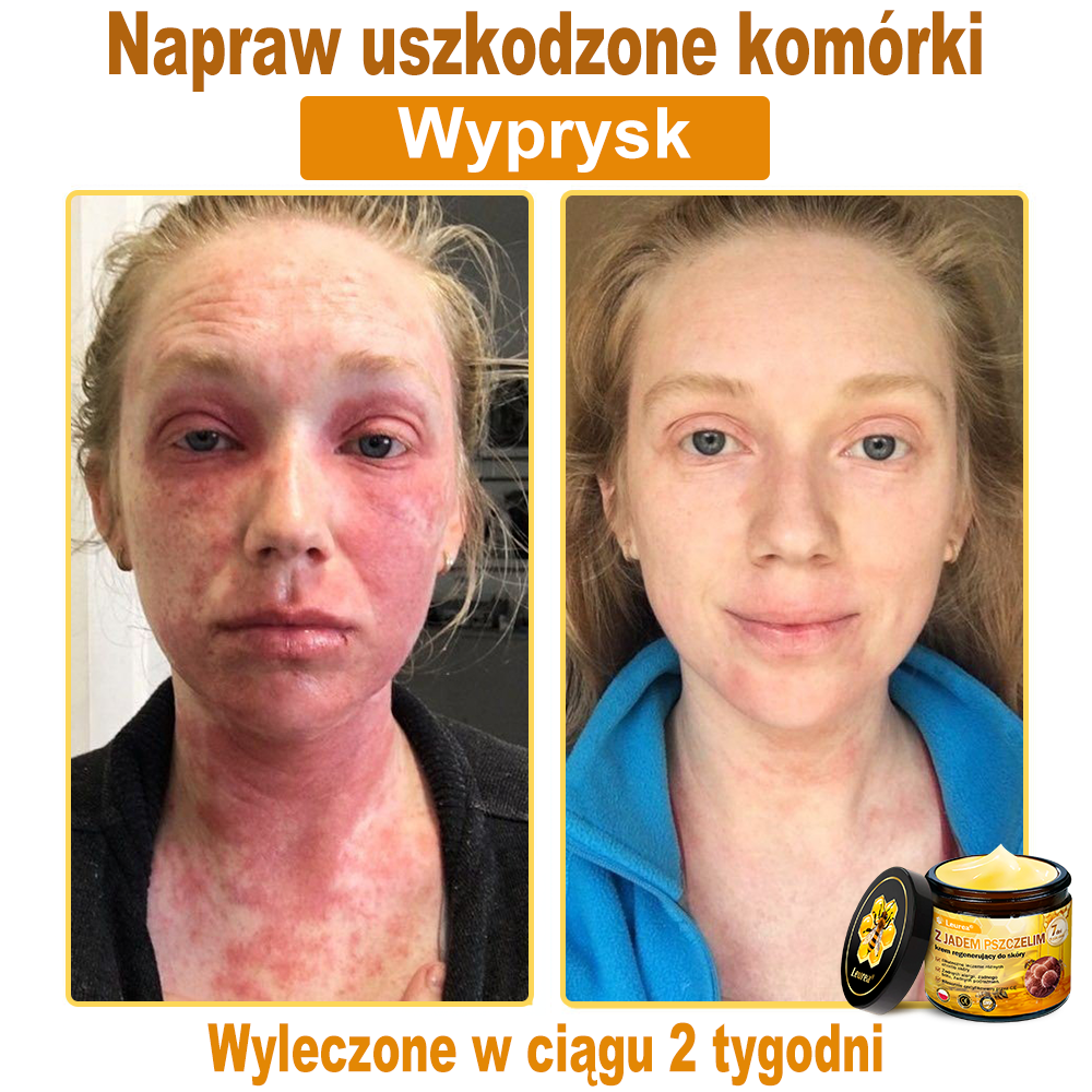 PL✨Leurea® Jad Pszczeli Regeneracja Skóry Krem🔥 Naturalna regeneracja skóry, wygładzenie zmarszczek i promienna cera-50 ml