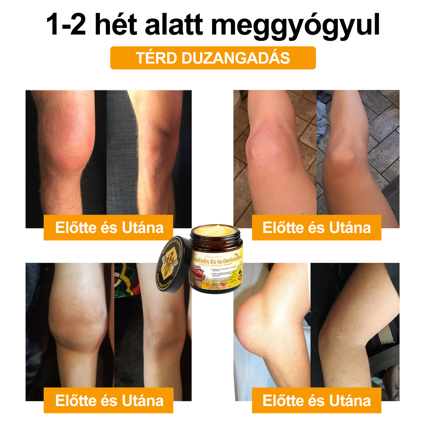 🐝🔥𝐈𝐳𝐮̈𝐥𝐞𝐭𝐢𝐕𝐢𝐭𝐚𝐥® 𝐌𝐞́𝐡 𝐌𝐞́𝐫𝐞𝐠 𝐈𝐳𝐮̈𝐥𝐞𝐭𝐢 𝐑𝐞𝐠𝐞𝐧𝐞𝐫𝐚́𝐥𝐨 𝐊𝐞𝐳𝐞𝐥𝐨̋ 𝐊𝐫𝐞́𝐦 (𝐔́𝐣-𝐙𝐞́𝐥𝐚𝐧𝐝𝐢 𝐌𝐞́𝐡 𝐊𝐢𝐯𝐨𝐧𝐚𝐭 - 𝐒𝐳𝐚𝐤𝐨𝐬𝐨𝐝𝐢𝐤 𝐨𝐫𝐭𝐨𝐩𝐞́𝐝 𝐛𝐞𝐭𝐞𝐠𝐬𝐞́𝐠𝐞𝐤𝐫𝐞 𝐞́𝐬 𝐢𝐳𝐮̈𝐥𝐞𝐭𝐢 𝐟𝐚́𝐣𝐝𝐚𝐥𝐨𝐦𝐫𝐚)