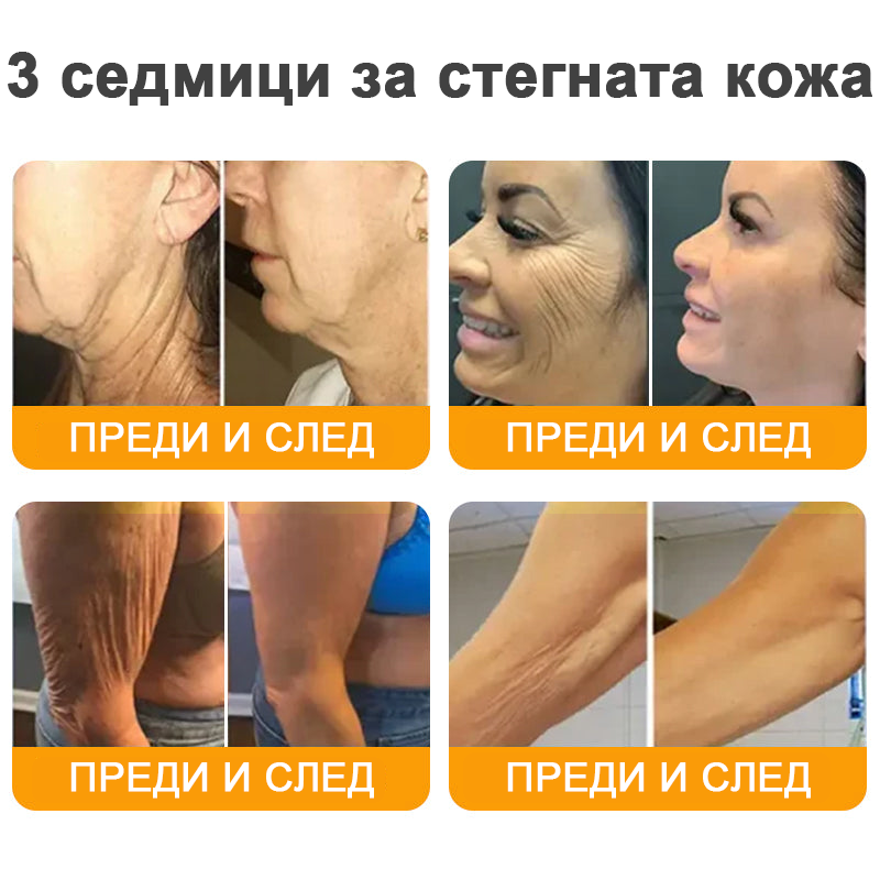 REHELY® Крем с пчелна отрова за регенерация на кожата – Подходящ за всички възрасти и типове кожа)