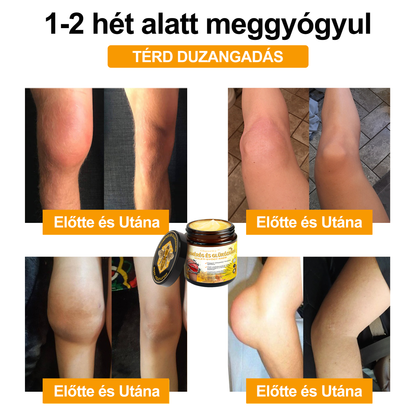 Gbpurity Méhméreg és Glükózamin Ízületi Krém – Hivatalos Márkabolt, MOT Jóváhagyással