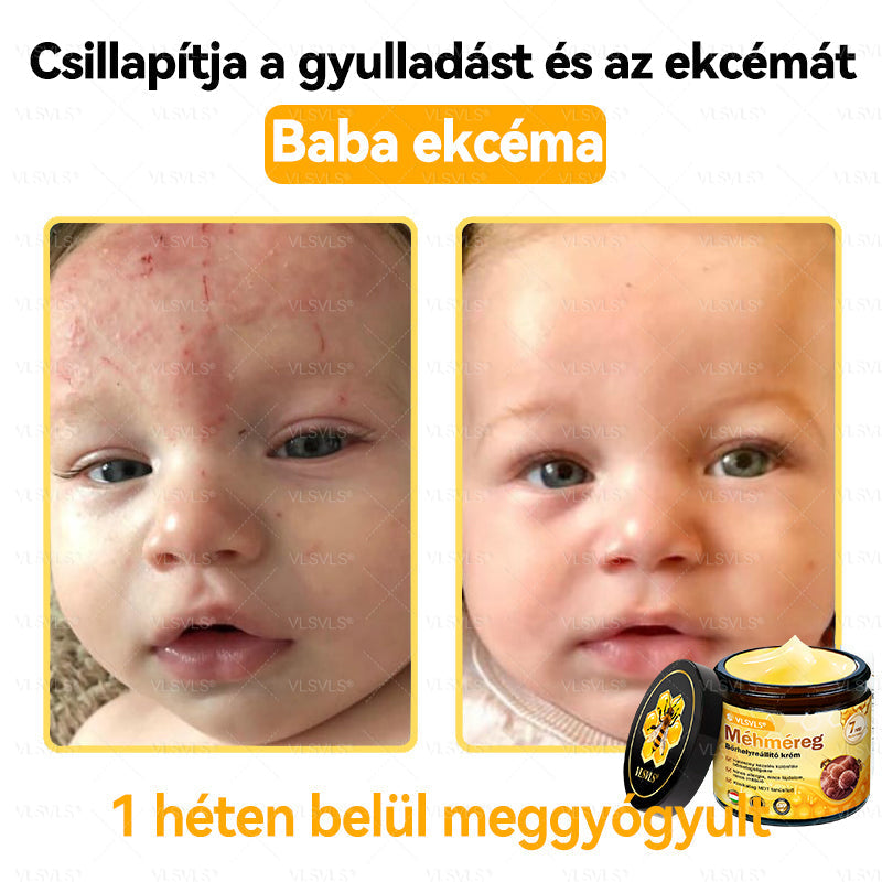 ✨✨✨💪VLSVLS® Méhméreg Bőrhelyreállító Krém (👨‍⚕‍CE jóváhagyott)👍✅
