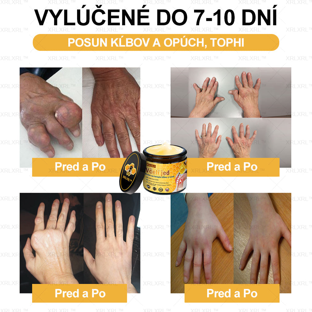 XRLXRL™ Krém na úľavu od bolesti a hojenie kostí s včelím jedom 🦴(Špeciálne pre starších dospelých a odporúčaný AAOS👍)
