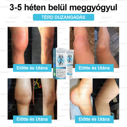 2️⃣ 𝐆𝐛𝐩𝐮𝐫𝐢𝐭𝐲™ 𝐇𝐢𝐚𝐥𝐮𝐫𝐨𝐧𝐬𝐚𝐯𝐚𝐬 Í𝐳ü𝐥𝐞𝐭𝐢 𝐑𝐞𝐠𝐞𝐧𝐞𝐫á𝐥ó 𝐊𝐫é𝐦👩‍⚕️(Á𝐭𝐟𝐨𝐠ó 𝐤𝐞𝐳𝐞𝐥é𝐬 𝐚𝐳 í𝐳ü𝐥𝐞𝐭𝐢 𝐠𝐲𝐮𝐥𝐥𝐚𝐝á𝐬𝐫𝐚, 𝐢𝐝𝐞𝐠𝐟á𝐣𝐝𝐚𝐥𝐨𝐦𝐫𝐚, 𝐢𝐳𝐨𝐦𝐟á𝐣𝐝𝐚𝐥𝐨𝐦0𝐫𝐚）