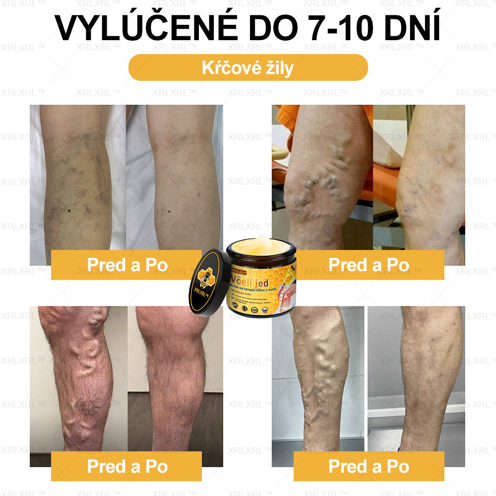 XRLXRL™ Krém na úľavu od bolesti a hojenie kostí s včelím jedom 🦴(Špeciálne pre starších dospelých a odporúčaný AAOS👍)