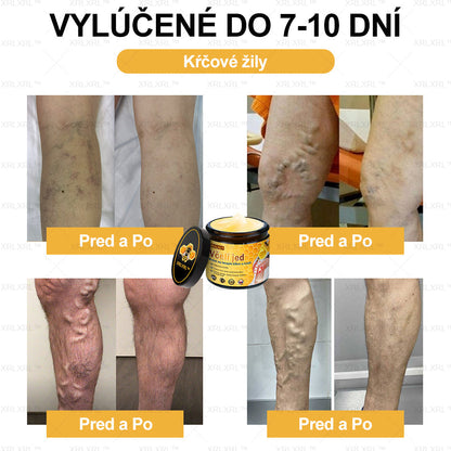 XRLXRL™ Krém na úľavu od bolesti a hojenie kostí s včelím jedom 🦴(Špeciálne pre starších dospelých a odporúčaný AAOS👍)