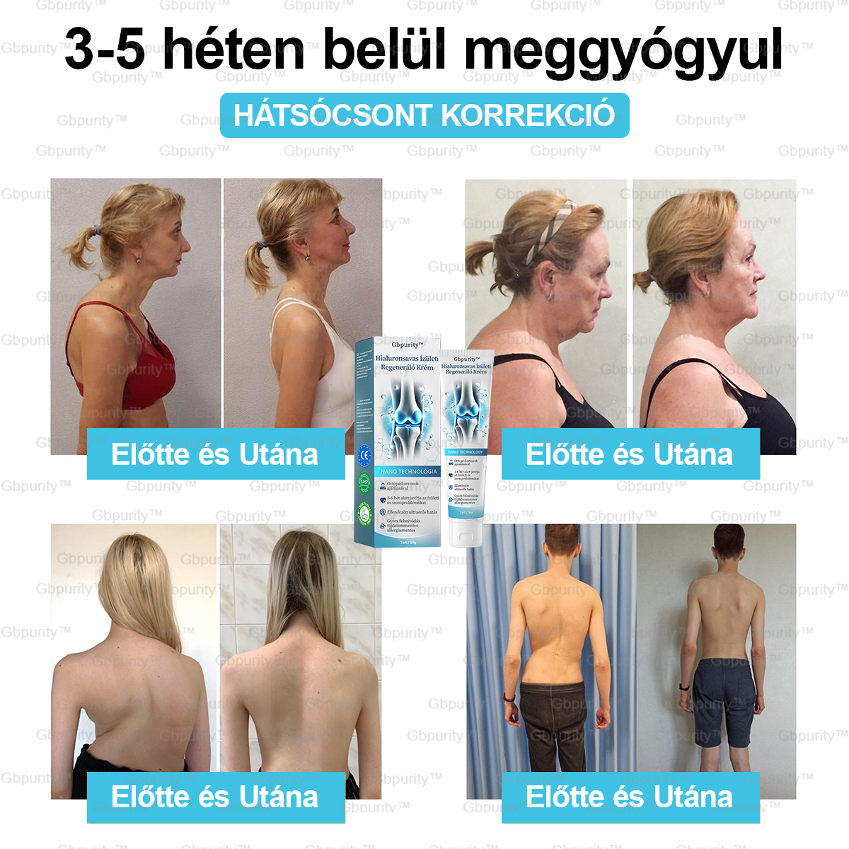 2️⃣ 𝐆𝐛𝐩𝐮𝐫𝐢𝐭𝐲™ 𝐇𝐢𝐚𝐥𝐮𝐫𝐨𝐧𝐬𝐚𝐯𝐚𝐬 Í𝐳ü𝐥𝐞𝐭𝐢 𝐑𝐞𝐠𝐞𝐧𝐞𝐫á𝐥ó 𝐊𝐫é𝐦👩‍⚕️(Á𝐭𝐟𝐨𝐠ó 𝐤𝐞𝐳𝐞𝐥é𝐬 𝐚𝐳 í𝐳ü𝐥𝐞𝐭𝐢 𝐠𝐲𝐮𝐥𝐥𝐚𝐝á𝐬𝐫𝐚, 𝐢𝐝𝐞𝐠𝐟á𝐣𝐝𝐚𝐥𝐨𝐦𝐫𝐚, 𝐢𝐳𝐨𝐦𝐟á𝐣𝐝𝐚𝐥𝐨𝐦0𝐫𝐚）