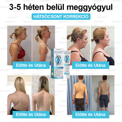 2️⃣ 𝐆𝐛𝐩𝐮𝐫𝐢𝐭𝐲™ 𝐇𝐢𝐚𝐥𝐮𝐫𝐨𝐧𝐬𝐚𝐯𝐚𝐬 Í𝐳ü𝐥𝐞𝐭𝐢 𝐑𝐞𝐠𝐞𝐧𝐞𝐫á𝐥ó 𝐊𝐫é𝐦👩‍⚕️(Á𝐭𝐟𝐨𝐠ó 𝐤𝐞𝐳𝐞𝐥é𝐬 𝐚𝐳 í𝐳ü𝐥𝐞𝐭𝐢 𝐠𝐲𝐮𝐥𝐥𝐚𝐝á𝐬𝐫𝐚, 𝐢𝐝𝐞𝐠𝐟á𝐣𝐝𝐚𝐥𝐨𝐦𝐫𝐚, 𝐢𝐳𝐨𝐦𝐟á𝐣𝐝𝐚𝐥𝐨𝐦0𝐫𝐚）