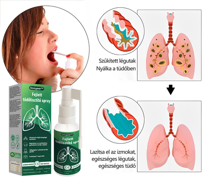 🍀𝐆𝐨𝐨𝐲𝐞𝐞𝐫™ Fejlett Tüdőtisztító Spray – Természetes támogatás a tüdő, hörgők és arcüreg egészségéért, a könnyebb légzésért