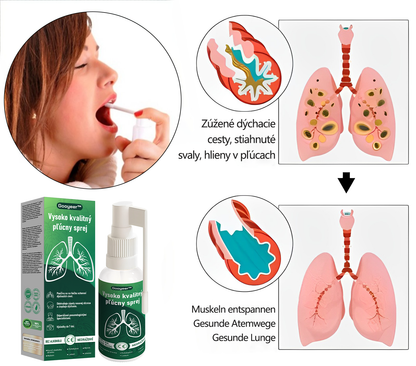 SVK🍀𝐆𝐨𝐨𝐲𝐞𝐞𝐫™ Vysoko kvalitný pľúcny sprej -🧑‍⚕️ Podporuje zdravie pľúc, priedušiek a dutín, podporuje zdravie dýchacieho systému a ľahšie dýchanie.