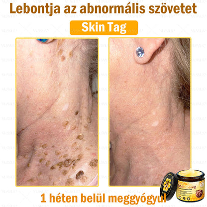 ✨✨✨💪VLSVLS® Méhméreg Bőrhelyreállító Krém (👨‍⚕‍CE jóváhagyott)👍✅