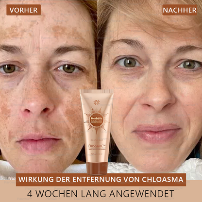 (40%-60% kedvezmény élvezete) 𝐅𝐑𝐈𝐒𝐒𝐀𝐑𝐂™ Fehérítő És Folteltávolító Arcmaszk - Természetes összetevők tartósan eltüntetik a foltokat, szeplőket és napfoltokat.