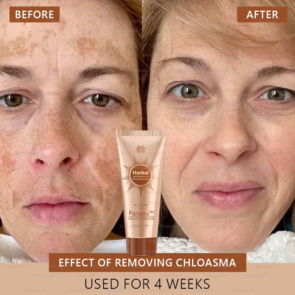 🏵️🏵️ Parowu™ Whitening and Spot-Removing Face Mask Suitable for face and body – 👩‍⚕️ Natural ingredients permanently remove age spots, freckles, sun spots, and liver spots.