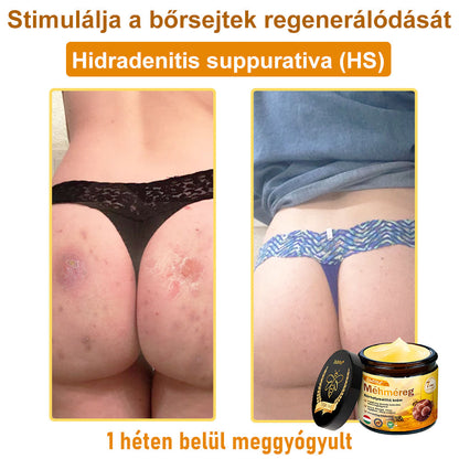 🐝🐝 ZödVita® Méhméreg Bőr Helyreállító Krém (👨‍⚕‍CE jóváhagyott)👍✅
