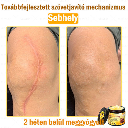 ✨✨✨💪VLSVLS® Méhméreg Bőrhelyreállító Krém (👨‍⚕‍CE jóváhagyott)👍✅