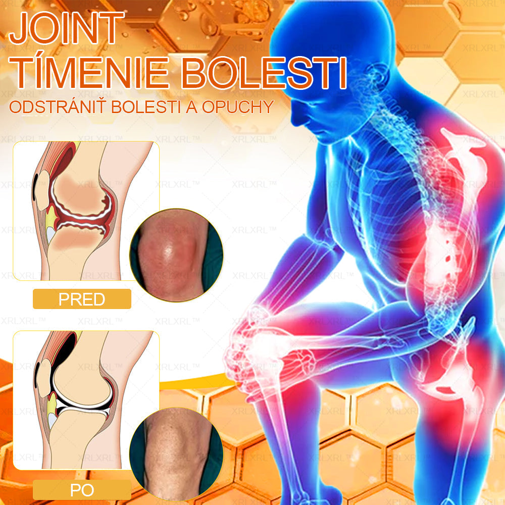 XRLXRL™ Krém na úľavu od bolesti a hojenie kostí s včelím jedom 🦴(Špeciálne pre starších dospelých a odporúčaný AAOS👍)