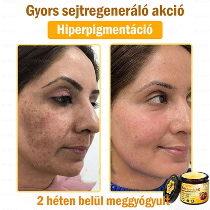 ✨✨✨💪VLSVLS® Méhméreg Bőrhelyreállító Krém (👨‍⚕‍CE jóváhagyott)👍✅