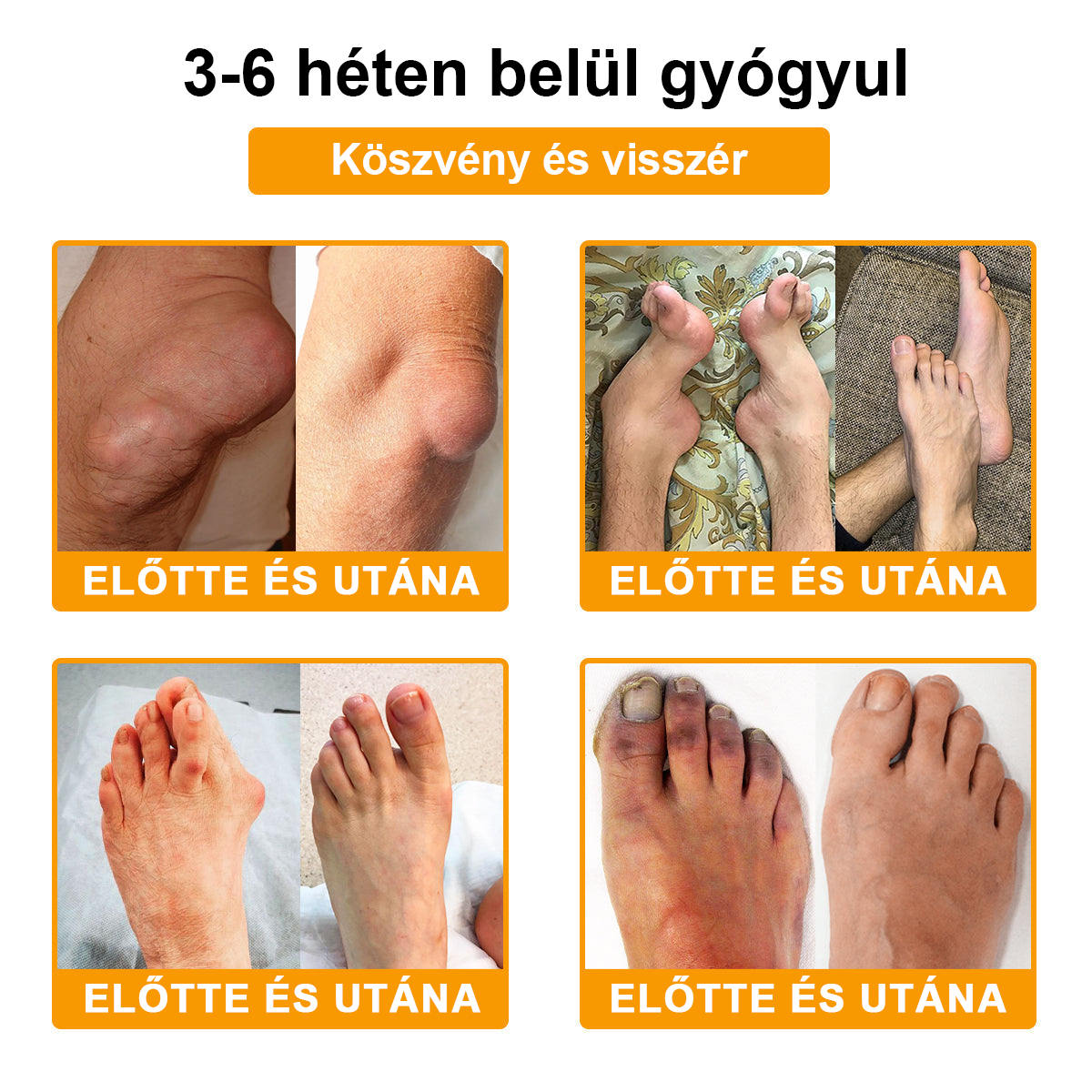 Gbpurity® Botulinum Toxin & Méhméreg Fájdalomcsillapító Krém 🍂 Hivatalos Márkabolt, MOT Jóváhagyással